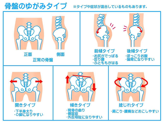 1日10分でok 骨盤体操で下半身がみるみる痩せる ダイエットプラス